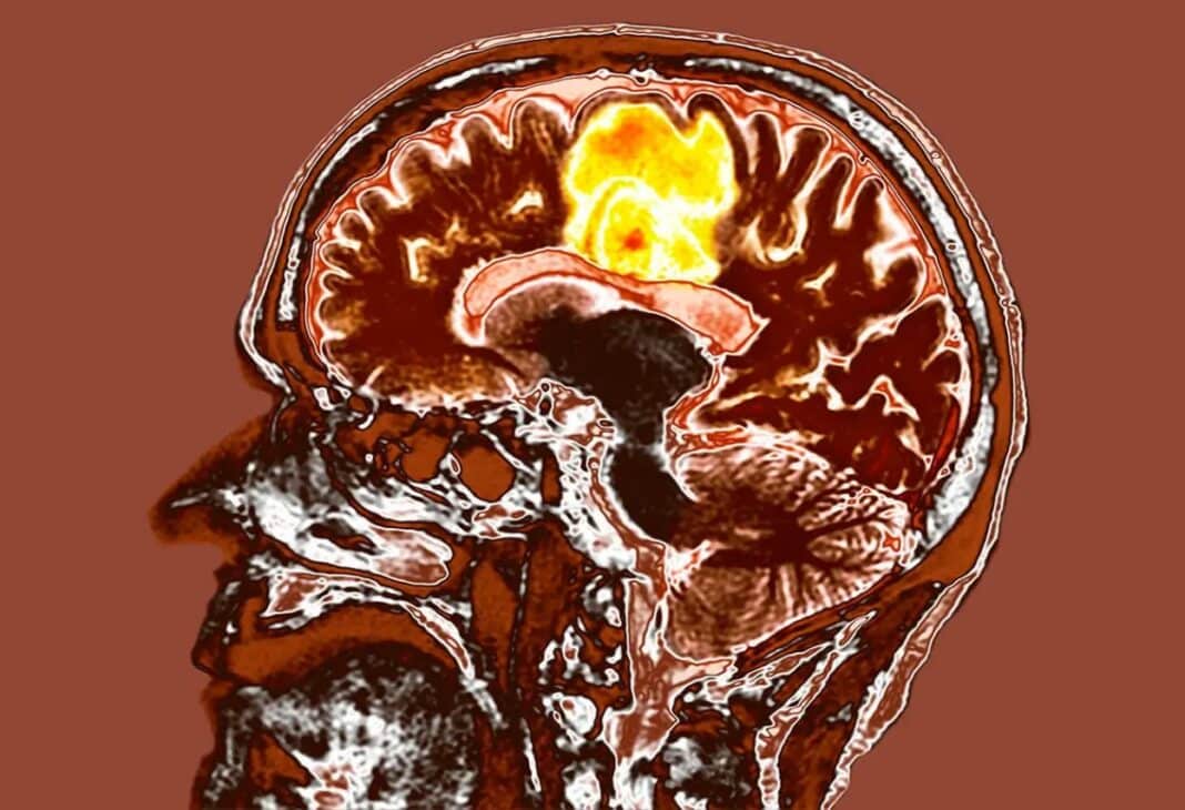 Manyetik Beyin konulu Psychology Times psikoloji yazısı için profesyonel görsel.